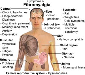 is cbd good for fibromyalgia