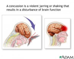 Concussion Injury to Brain