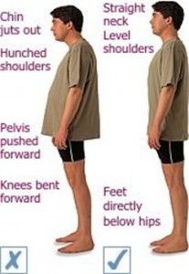 chiropractic posture examples