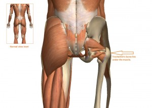 The bursa provides a cushion between the trochanter of the femur and the TFL muscle.